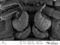 Hirudicryptus canariensis - Gonopods