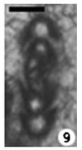Asselodiscus davydovi Vachard & Moix, 2011