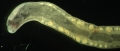 Nemertea (ribbon worms)
