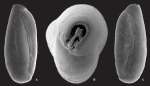 Quinqueloculina tantabiddyensis Parker, 2009