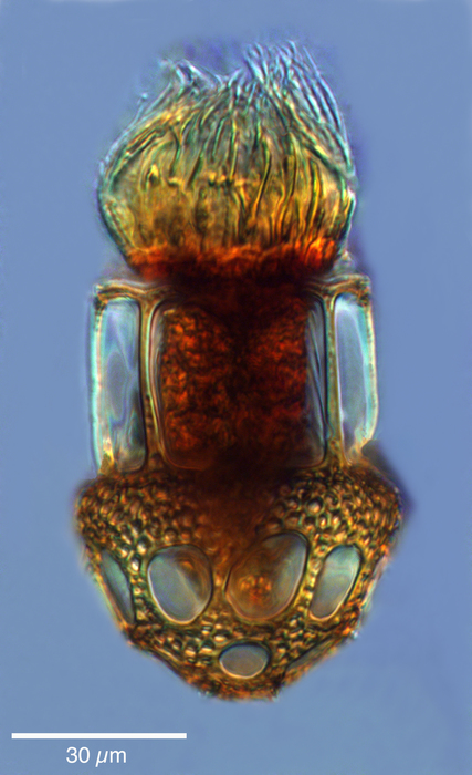 Dictyocysta lepida Ehrenberg, 1854