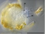 Pensilisphaera antarcticaensis Solbach, Siemensma & Holzmann, 2025