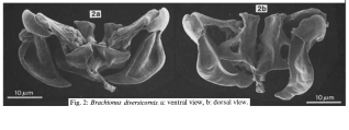 Brachionus diversicornis, author: Christian D. Jersabek