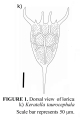 Keratella taurocephala, author: Christian D. Jersabek