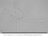 Synchaeta tremula, author: Christian D. Jersabek