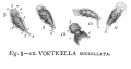 Vorticella succollata