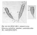 Vorticella vermicularis