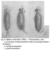 Vorticella vermicularis