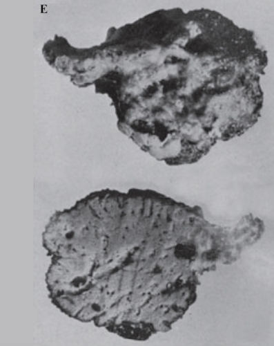 Spongia (Spongia) officinalis Linnaeus, 1759 neotype Spongia (Spongia) officinalis Linnaeus, 1759 neotype