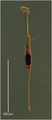 Amphisolenia globifera