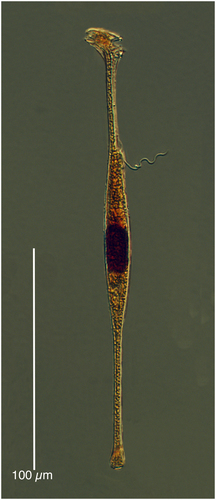 Amphisolenia globifera Amphisolenia globifera