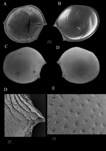 Thaumatoconcha quasiporosa Karanovic & Brandão, 2011 from the original description Thaumatoconcha quasiporosa Karanovic & Brandão, 2011 from the original description