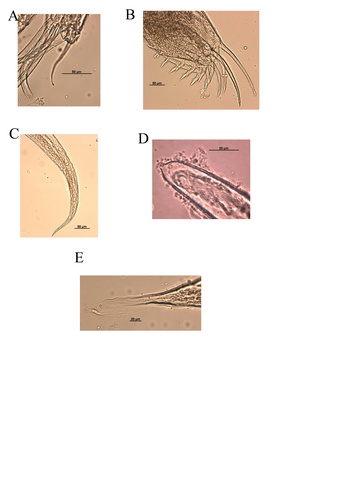 Thaumatoconcha quasiporosa Karanovic & Brandão, 2011 from the original description Thaumatoconcha quasiporosa Karanovic & Brandão, 2011 from the original description