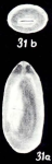 Fissurina labiosiformis McCulloch, 1981