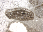 Hensonipapillus cantabricus Schlagintweit, Rigaud & Wilmsen, 2015 holotype