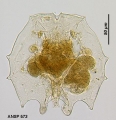 Brachionus dolabratus, author: Christian D. Jersabek