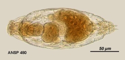 Drilophaga judayi, author: Christian D. Jersabek