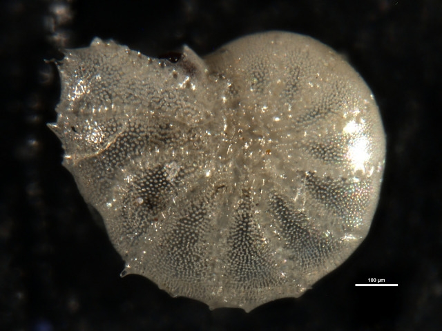 Elphidium spinatum CUSHMAN and VALENTINE 1930, holotype