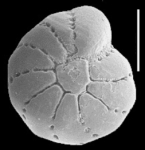 Cribrononion illawarraensis ALBANI and YASSINI 1993, figs. 24–25, holotype