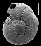 “Elphidium” limpidum He, Hu and Wang, 1965, identified specimen, China.