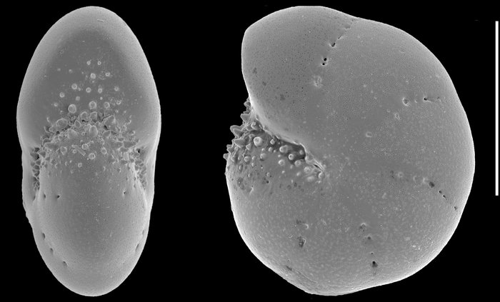 Elphidium somaense Takayanagi, 1955,  juvenile specimen, Japan,