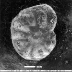Cibicidoides durhami Smith, 1957