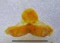 Anterior gonopod sternum