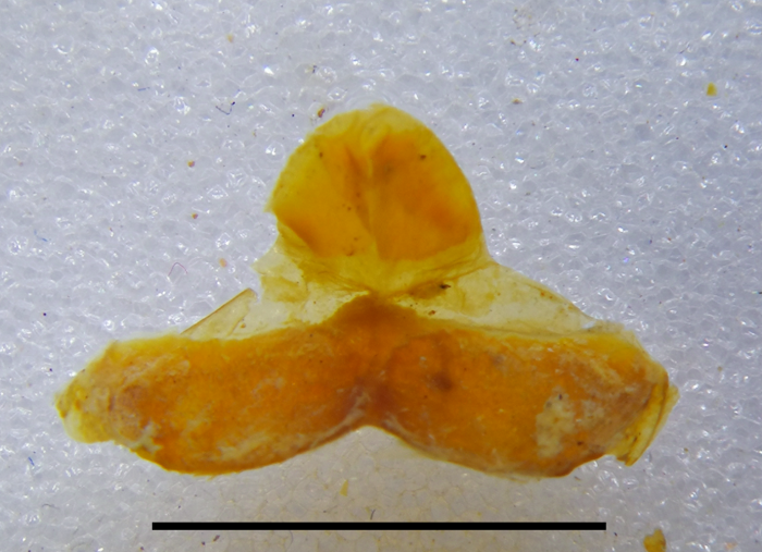 Anterior gonopod sternum