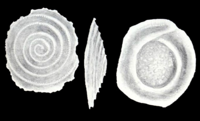 Conicospirillina (?) delicatiformis McCulloch, 1981