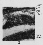 Fusulinella juncea Thompson, 1948