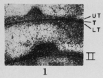 Profusulinella regia Thompson, 1948