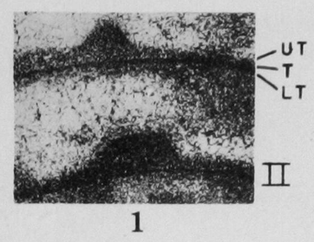 Profusulinella regia Thompson, 1948