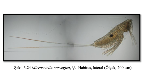 Microsetella norvegica