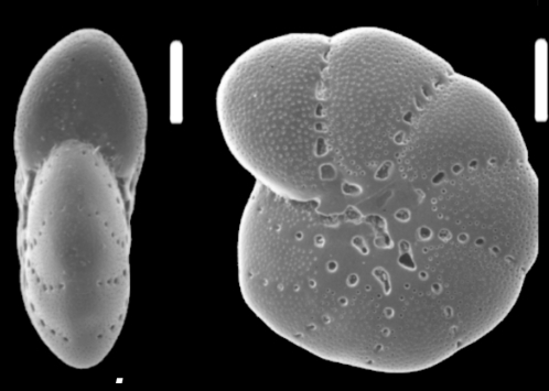 Elphidium selseyense (Heron-Allen and Earland) syntype