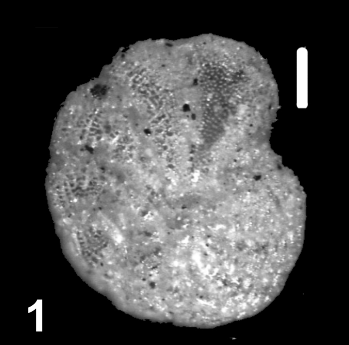 Hispidoelphidium hispidulum (Cushman 1936), holotype, USNM CC 23028, Australia,