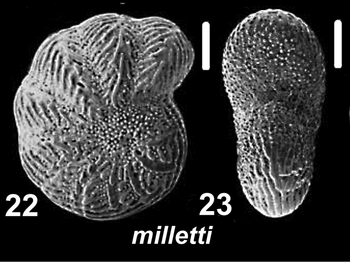  Millettoelphidium milletti (Heron-Allen and Earland 1915), unsequenced specimen, Saudi Arabia