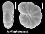 Elphidium feylinghansseni Hayward, Parker and Langer 2025 holotype