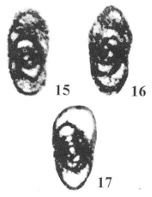 Plectostaffella (Varvariella) varvariensis (Brazhnikova &amp; Potievskaya, 1948)