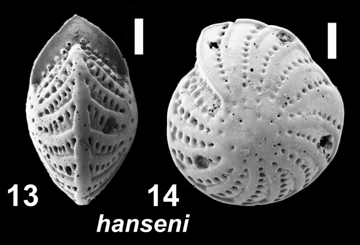 Elphidium hanseni Hayward 2025, paratype, TF1685/2, Indonesia