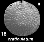 Elphidium craticulatum (Fichtel and Moll 1798), unsequenced specimen, Saudi Arabia,, author: Hayward, Bruce W.