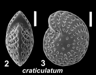 Elphidium craticulatum (Fichtel and Moll 1798), unsequenced juvenile specimen, Oman, author: Hayward, Bruce W.