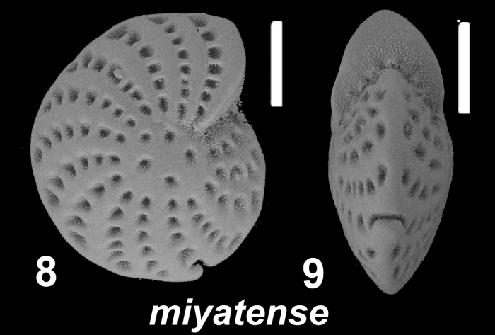 Elphidium miyatense Fujita 1956, S30, sequenced specimen, 