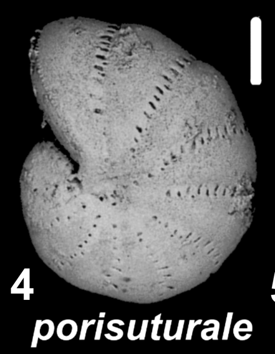 Elphidium porisuturale (Zheng 1978), unsequenced specimen, Australia, Lord Howe I.,