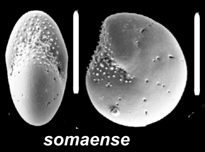 Elphidium somaense Takayanagi 1955, unsequenced specimen, South Korea,