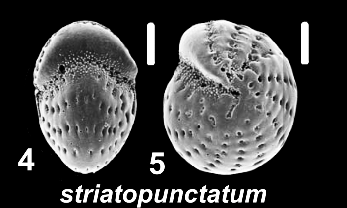 Elphidium striatopunctatum (Fichtel and Moll 1798), unsequenced juvenile specimen, Saudi Arabia
