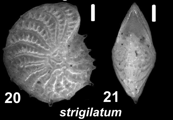 Elphidium strigilatum (Fichtel and Moll 1798), unsequenced specimen, FEU 1015961, United Kingdom