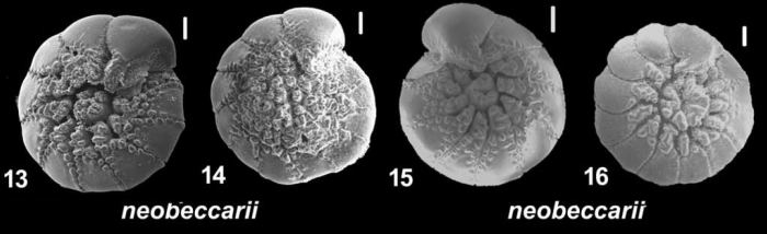 Ammonia neobeccarii Shchedrina and Mayer 1975, T17, isolate 19574, unsequenced specimens