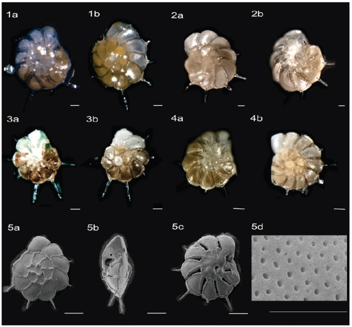 Ammonia nigami Kaushik &amp; Dixit, 2025 holotype asnd paratypes