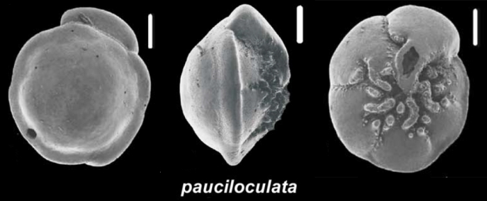 Ammonia pauciloculata (Phleger and Parker 1951), unsequenced specimen