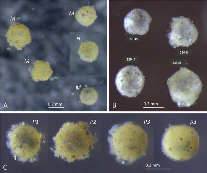 Lorneia sphaerica Henderson, Holzmann &amp; Gooday, 2026